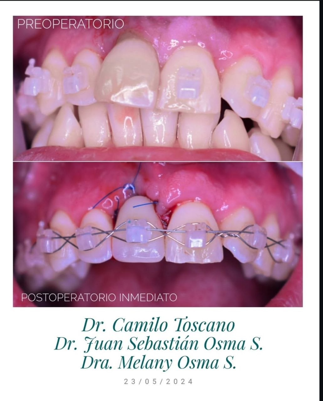 Trabajo de odontología DentArt Family en el norte de Bogotá