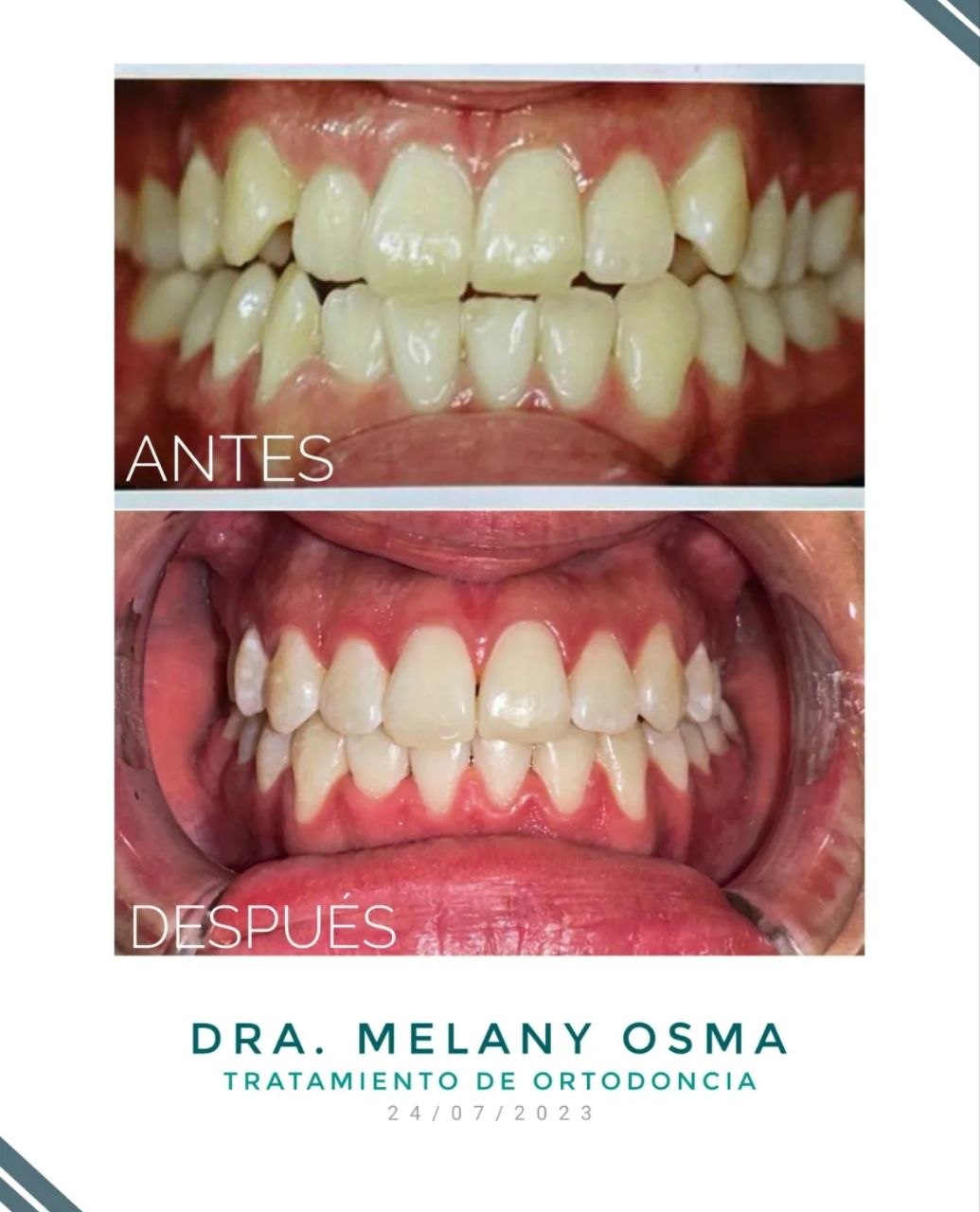 Trabajo de odontología DentArt Family en el norte de Bogotá