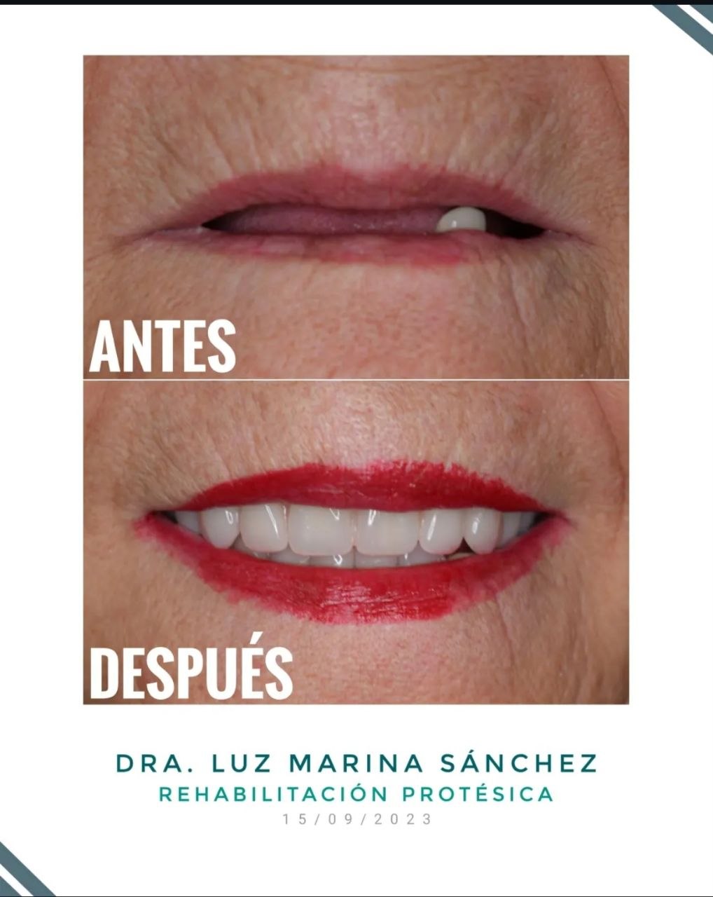 Trabajo de odontología DentArt Family en el norte de Bogotá